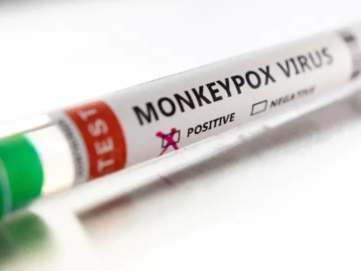 Descubrimiento de una cepa mutante de viruela del mono en el Congo