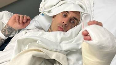 Travis Barker publica foto de su operación y agradeció el cariño y comprensión de sus fans