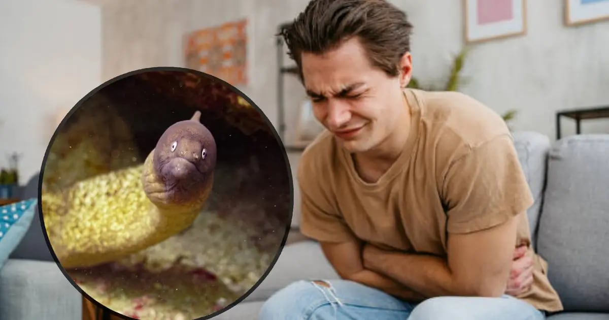 Doctors discover a 30cm long eel alive in a man's stomach;  Enter into his rectum  News from Mexico