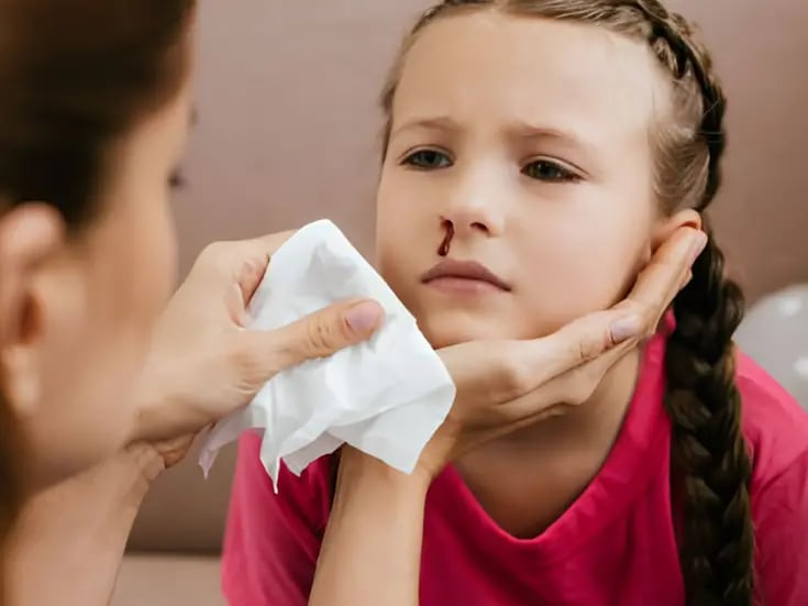 ¿Cuáles son las causas del sangrado nasal en niños?