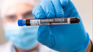 CDC advierte a médicos de EU sobre virus Marburg en medio de brote en dos naciones africanas