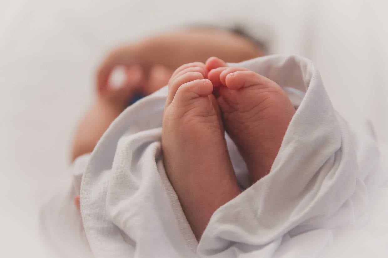 La anoftalmía es un defecto de nacimiento en el cual el bebé nace sin uno o ambos ojos.