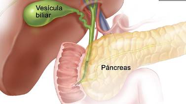 Cuida vesícula y páncreas, evita el consumo de grasas y alcohol en exceso