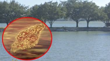 Residente de Texas muere a causa de una infección rara por ameba después de nadar en un lago