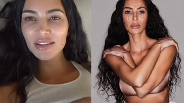 Kim Kardashian habla sobre su experiencia con el acné y la psoriasis