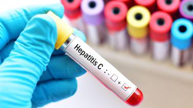 Riesgos de la Hepatitis C en el Norte de México
