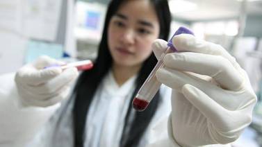 Promueven pruebas de VIH/Sida entre grupos de riesgo