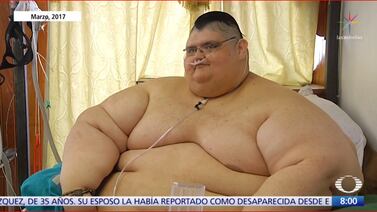 Juan Pedro perdió más de 300 kilos de los 600 que pesaba y ya puede caminar