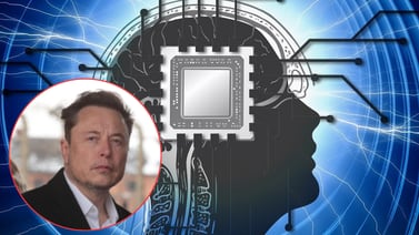 Primer humano con un chip en su cerebro: ¿Cómo funciona y cuál es el objetivo del plan de Elon Musk con Neuralink?