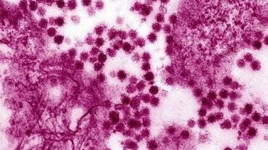 Hay riesgo de que el Virus del Nilo Occidental llegue a Baja California