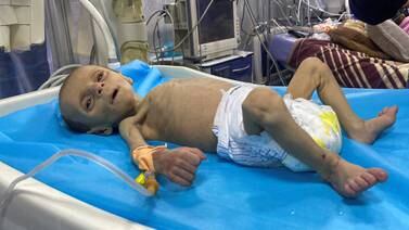 Alertan sobre la hambruna en Gaza y acusa a Israel de obstruir la ayuda humanitaria
