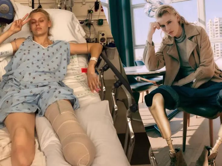 Lauren Wasser: la famosa modelo a la que le amputaron ambas piernas por usar tampones