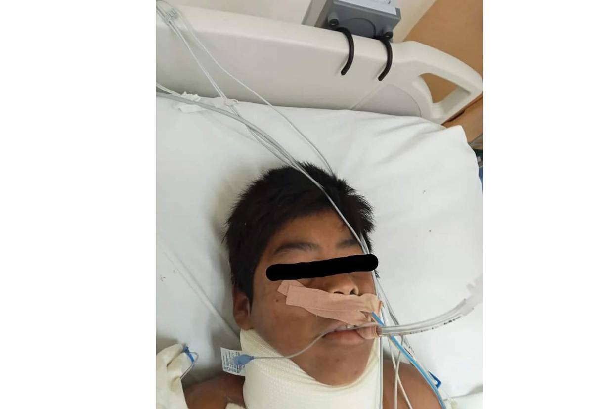 Aramis o Aramos Ramos Rangel, de aproximadamente 12 años de edad se encuentra en estado grave en el Hospital General de Ensenada.