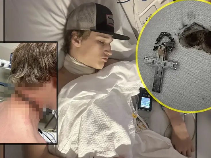 Crucifijo provoca que un adolescente de 16 años casi muera en un extraño accidente por electrocutación