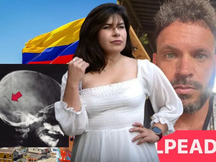 Mexicana escapa con cráneo herido de vacaciones en Colombia por violencia de su ex pareja