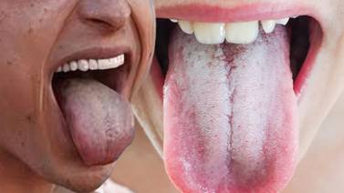 ¿Por qué la lengua se pone color blanco? Chat GPT recopila información de expertos