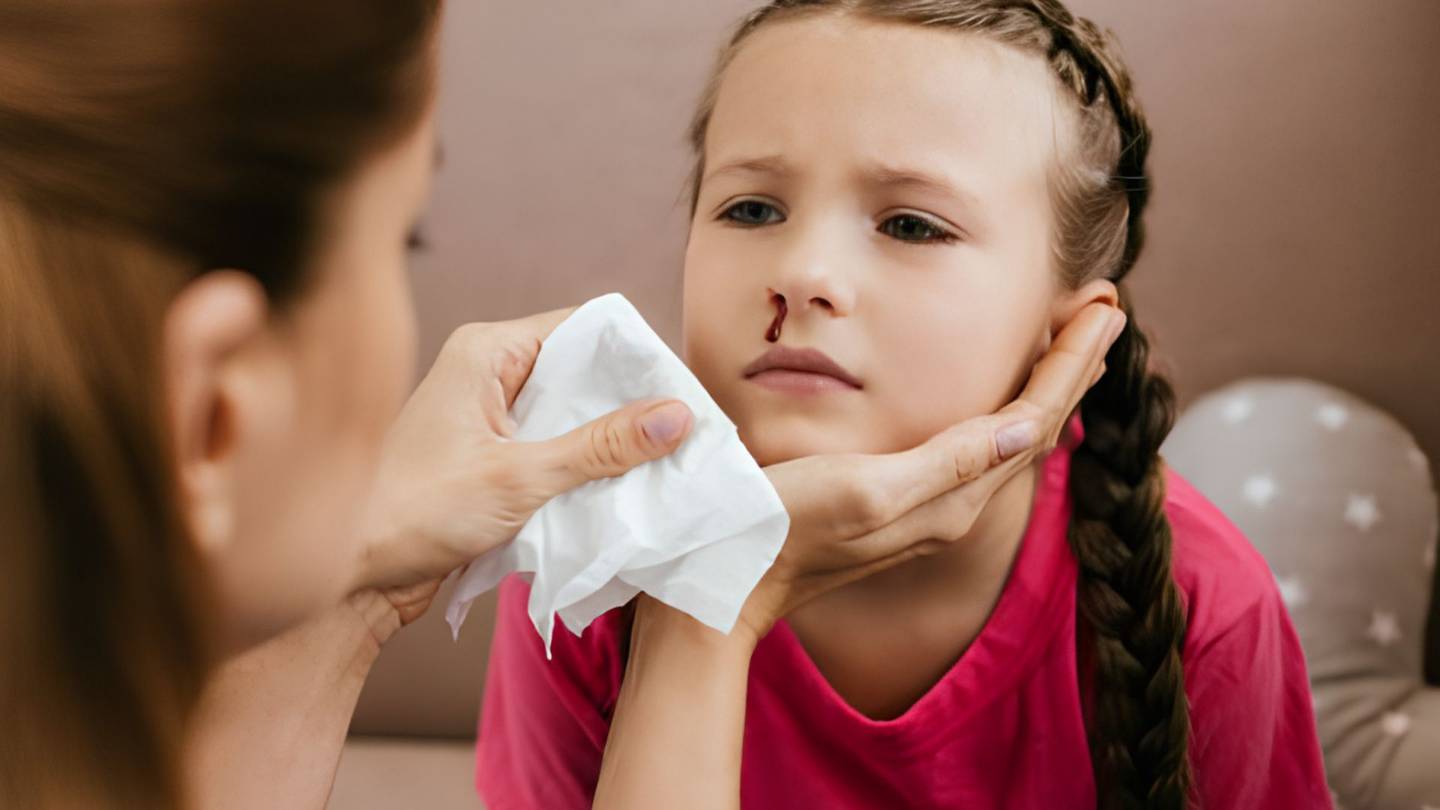 La mayoría de los sangrados nasales en infantes se atribuyen a la fragilidad del tejido nasal | Foto: iStock