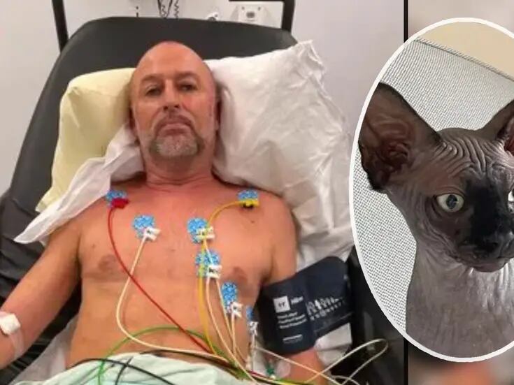 Hombre tropezó con su gato y le dejó lesiones similares a las de un fuerte accidente automovilístico: “Tengo suerte de estar vivo”