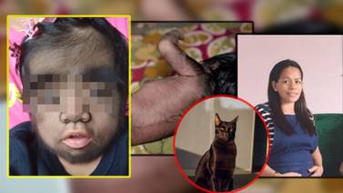 VIDEO: Madre da a luz a bebé lleno de pelo y culpa a una maldición por comer carne de gato