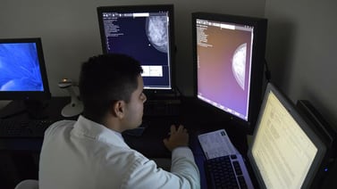 Realizan mastografías gratuitas en hospital general de Ensenada 
