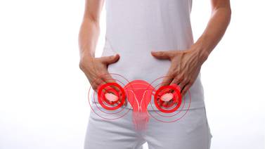 Advierte IMSS sobre repercusiones de ovario poliquístico