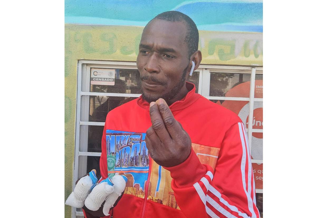 El migrante haitiano Maxo Dorvil perdió cuatro dedos en un accidente de trabajo.