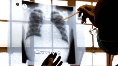 Detecta Jurisdicción 232 casos de tuberculosis