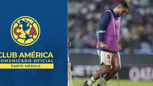 Club América: Sebastián Cáceres será operado y se perderá la liguilla