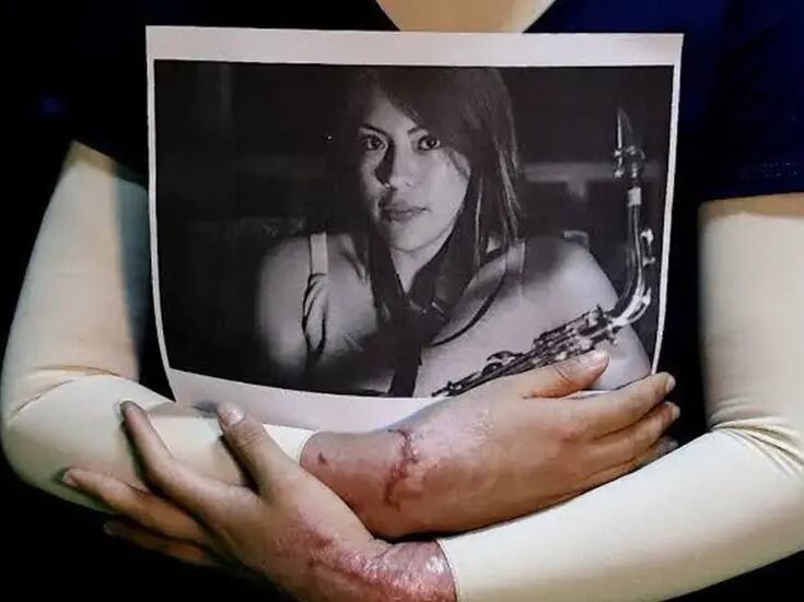 Gobierno de CDMX publica “Ley Malena”; ataques con ácido serán considerados tentativa de feminicidio