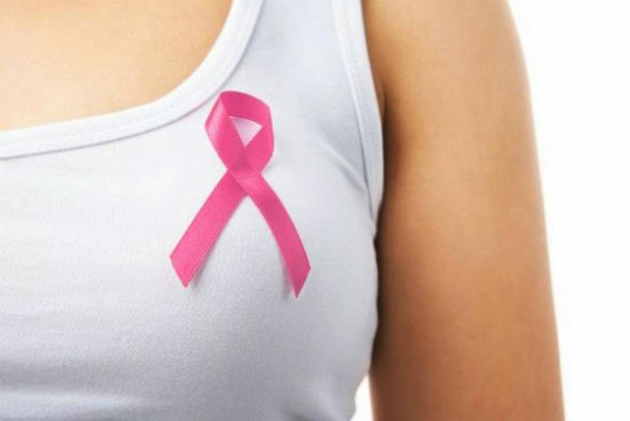 Especialistas dicen que mamografías deberían de comenzar desde los 40 años / Fotografía de Archivo