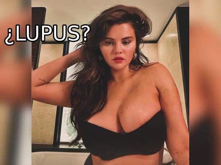 ¿Pechos de Selena Gomez se hincharon por el Lupus?