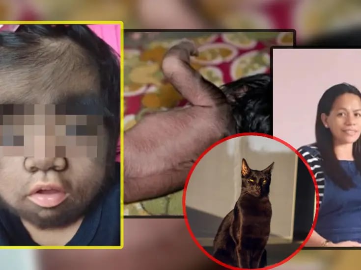 VIDEO: Madre da a luz a bebé lleno de pelo y culpa a una maldición por comer carne de gato