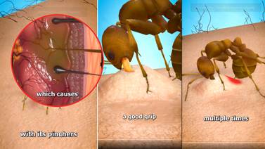 ¿Qué hacen las hormigas tras morderte? Se viraliza respuesta a su peculiar meneo