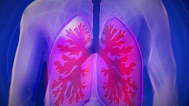 Cáncer de pulmón podría causar la muerte de 160 mil latinoamericanos en los próximos 10 años: AstraZaneca