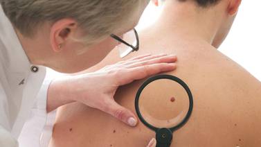 Alerta médica en Sonora por aumento en casos de cáncer de piel