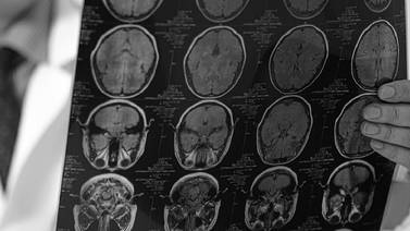 Neuropsicología con área de oportunidad para identificar afecciones cognitivas ante el Covid-19