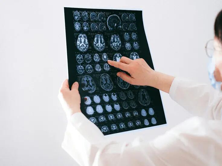 Estudio explica si el cerebro permanece consciente después de la muerte