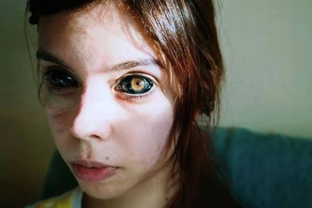 Joven se tatúa los ojos de negro y queda ciega