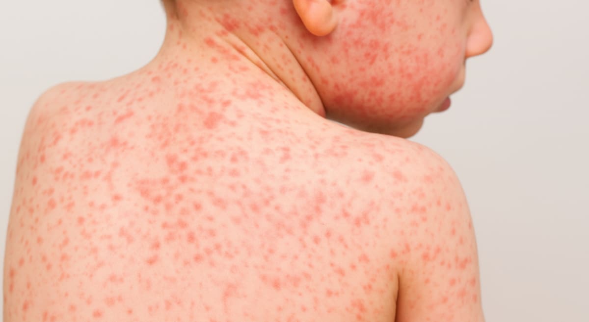 Ilustrativa de archivo.