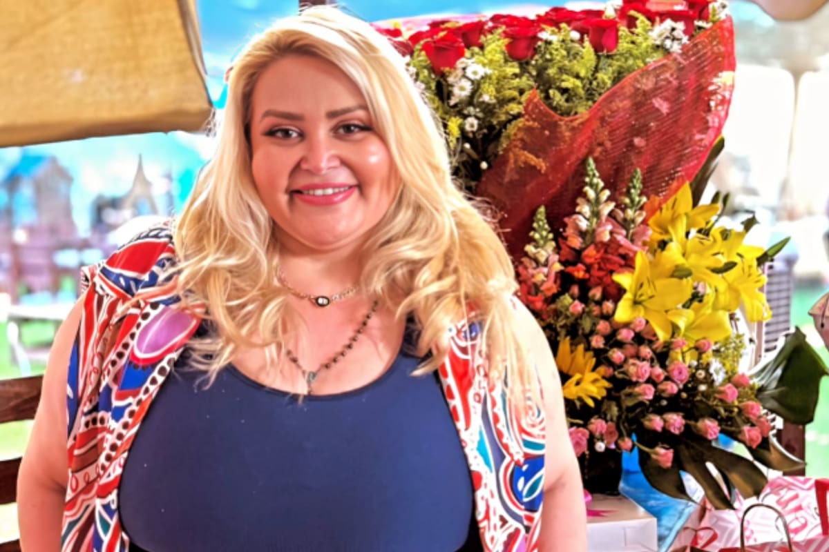 Sheyla confiesa que donó su piel sobrante tras perder más de 50 kilos