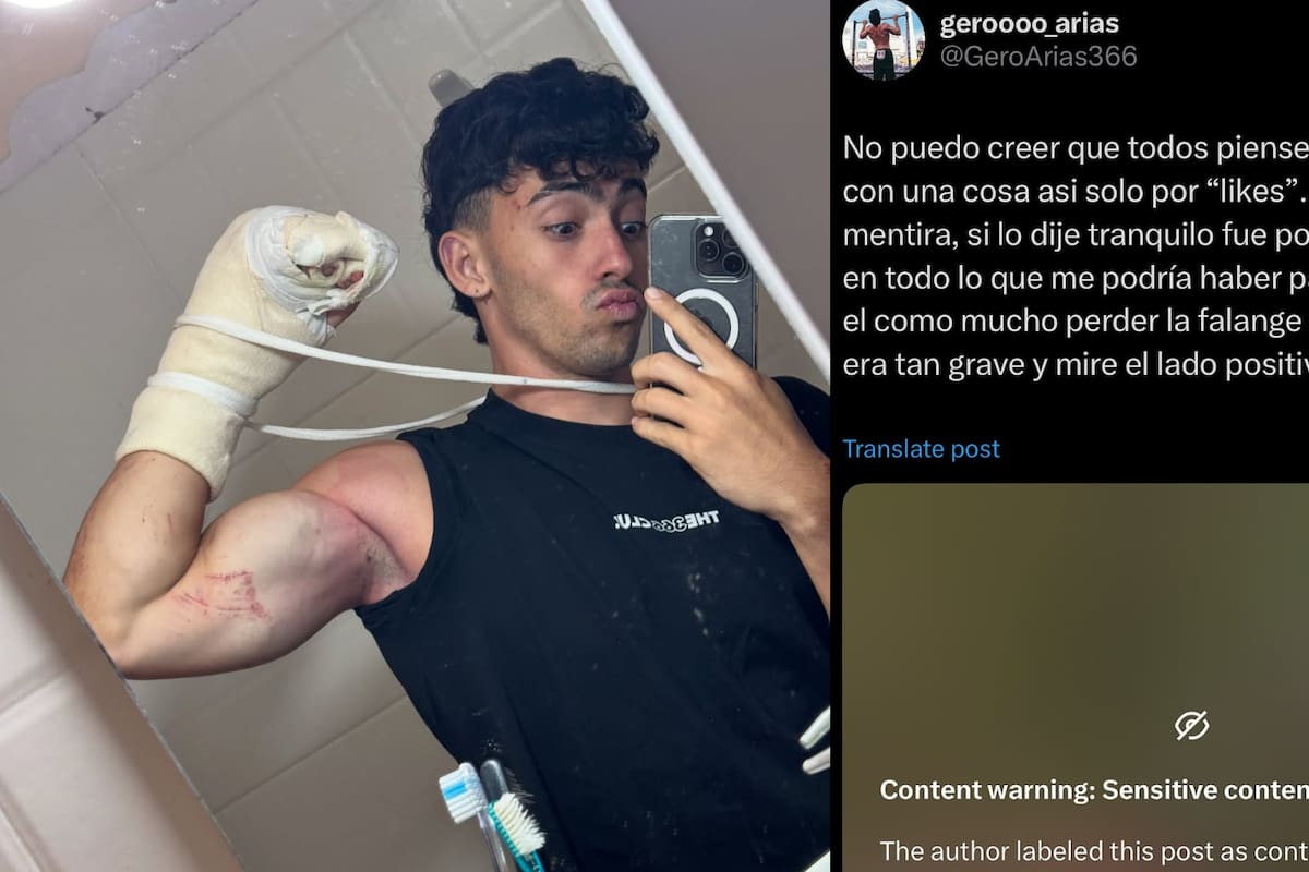 Influencer cayó de un acantilado y perdió 2 dedos de la mano
