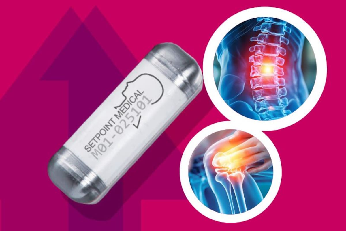 Una nueva esperanza para pacientes con artritis reumatoide