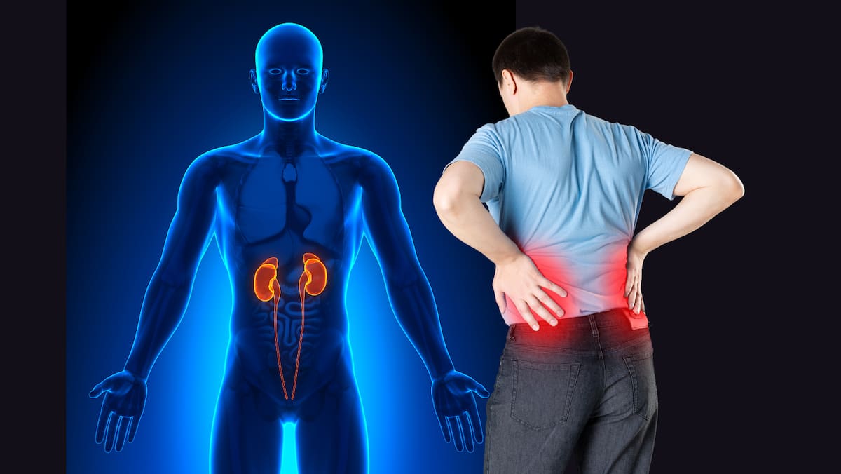 La enfermedad renal crónica avanza de forma silenciosa, pero constante, en todo el mundo.