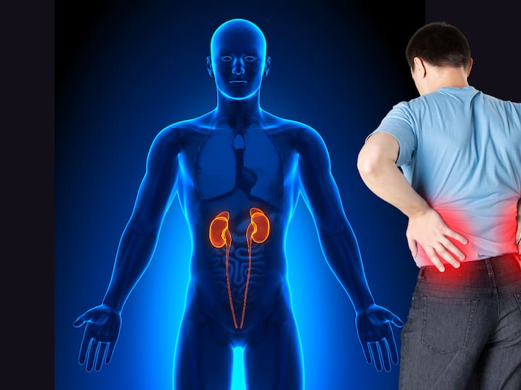 La enfermedad renal crónica se duplica en 30 años: ¿Qué está pasando con nuestros riñones y cómo prevenirlo?