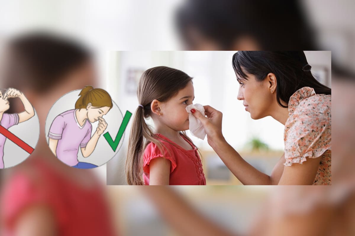 Sangrado nasal es muy común en niños menores de 5 años