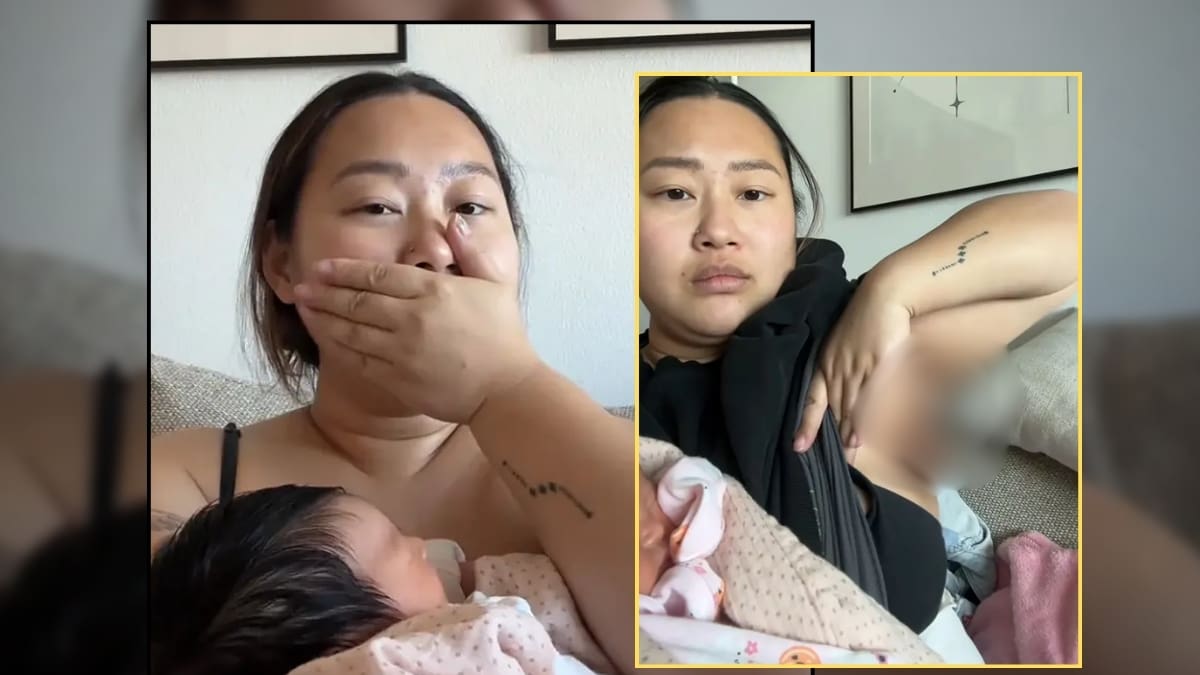Una mujer dio a luz a su bebé y luego descubrió que le salió un tercer pecho con pezón en la axila (VIDEO)