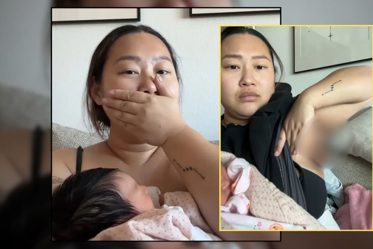 Una mujer dio a luz a su bebé y luego descubrió que le salió un tercer pecho con pezón en la axila (VIDEO)