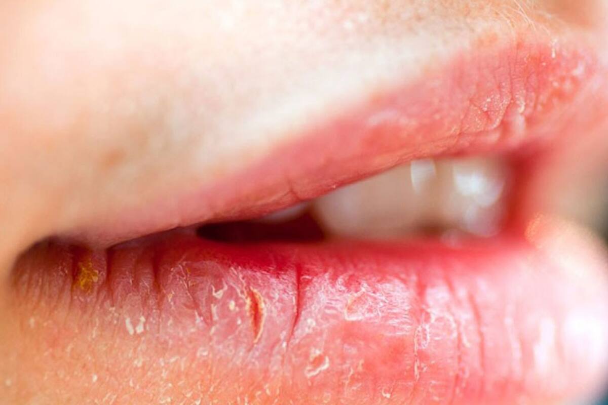 Combate los labios secos en invierno
