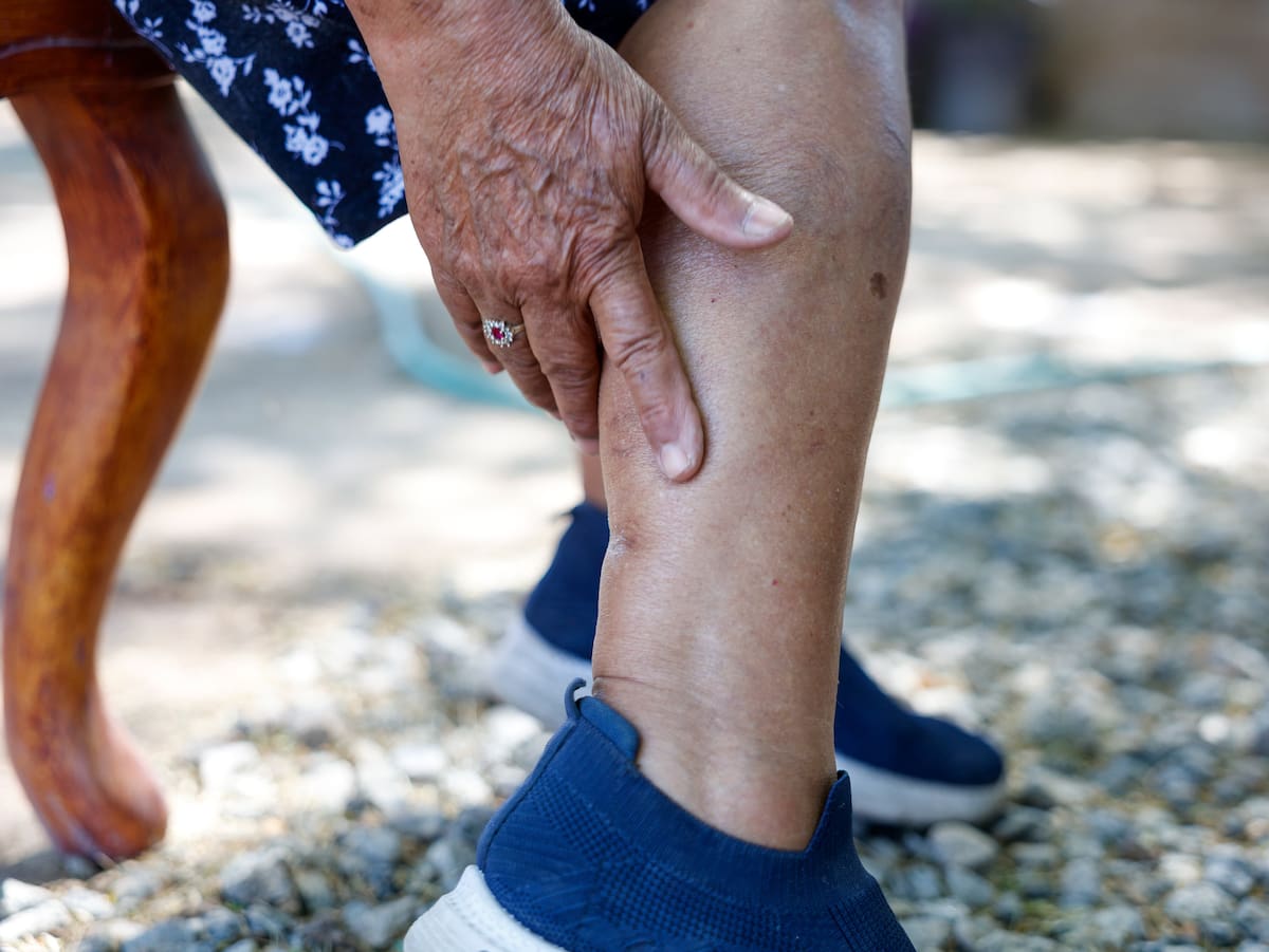 Recibió heridas en manos y una pierna, al perder el conocimiento l Foto: Juan J. Morales