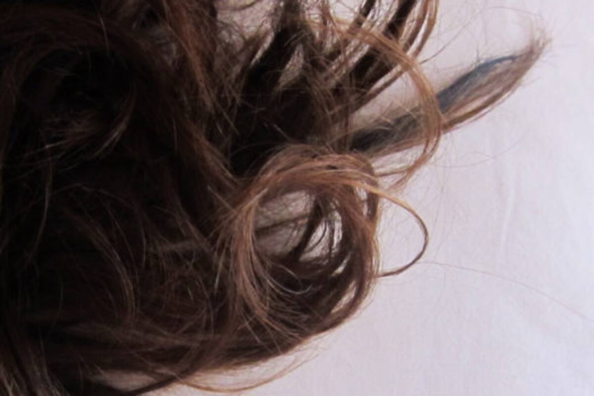 Le quitan a una menor una bola de cabello de su estómago